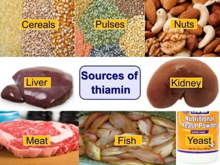 Sources of
thiamin
Yeast
Kidney
FishMeat
Pulses
Liver
Cereals Nuts
 