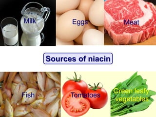 Sources of niacin
Eggs
Fish Tomatoes
Green leafy
vegetables
Milk Meat
 