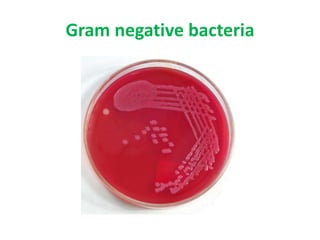 Gram negative bacteria
 
