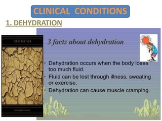 CLINICAL CONDITIONS
1. DEHYDRATION
 
