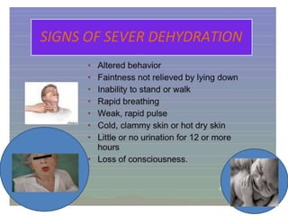 SIGNS OF SEVER DEHYDRATION
 