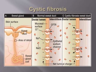 Water and electrolytes balance ss 