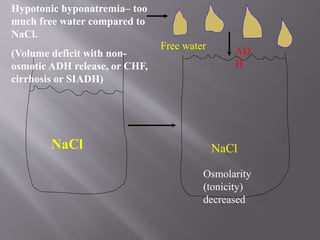 NaCl NaCl
Free water
Hypotonic hyponatremia– too
much free water compared to
NaCl.
(Volume deficit with non-
osmotic ADH release, or CHF,
cirrhosis or SIADH)
Osmolarity
(tonicity)
decreased
AD
H
 