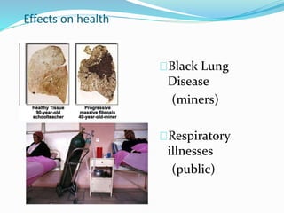 Effects on health 
Black Lung 
Disease 
(miners) 
Respiratory 
illnesses 
(public) 
 