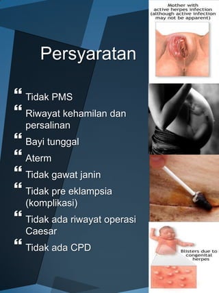 Persyaratan

 Tidak PMS
 Riwayat kehamilan dan
  persalinan
 Bayi tunggal
 Aterm
 Tidak gawat janin
 Tidak pre eklampsia
  (komplikasi)
 Tidak ada riwayat operasi
  Caesar
 Tidak ada CPD
 