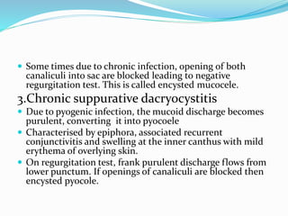  Some times due to chronic infection, opening of both
canaliculi into sac are blocked leading to negative
regurgitation test. This is called encysted mucocele.
3.Chronic suppurative dacryocystitis
 Due to pyogenic infection, the mucoid discharge becomes
purulent, converting it into pyocoele
 Characterised by epiphora, associated recurrent
conjunctivitis and swelling at the inner canthus with mild
erythema of overlying skin.
 On regurgitation test, frank purulent discharge flows from
lower punctum. If openings of canaliculi are blocked then
encysted pyocole.
 