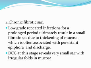 4.Chronic fibrotic sac.
 Low grade repeated infections for a
prolonged period ultimately result in a small
fibrotic sac due to thickening of mucosa,
which is often associated with persistant
epiphora and discharge.
 DCG at this stage reveals very small sac with
irregular folds in mucosa.
 