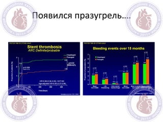 Появился празугрель….
 
