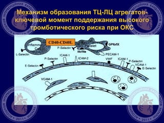 Механизм образования ТЦ-ЛЦ агрегатов-
ключевой момент поддержания высокого
тромботического риска при ОКС
CD40-CD40L
 