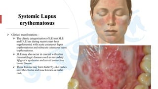 Sle Rash Vs Dle Rash DIFFERENTIAL DIAGNOSIS OF LYMPHADENOPATHY | PDF