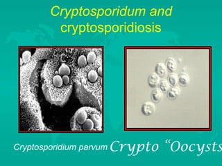 Cryptosporidum and
cryptosporidiosis
Cryptosporidium parvum Crypto “Oocysts
 
