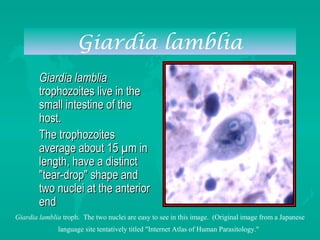 Giardia lamblia
Giardia lambliaGiardia lamblia
trophozoites live in thetrophozoites live in the
small intestine of thesmall intestine of the
host.host.
The trophozoitesThe trophozoites
average about 15 µm inaverage about 15 µm in
length, have a distinctlength, have a distinct
"tear-drop" shape and"tear-drop" shape and
two nuclei at the anteriortwo nuclei at the anterior
endend
Giardia lamblia troph. The two nuclei are easy to see in this image. (Original image from a Japanese
language site tentatively titled "Internet Atlas of Human Parasitology."
 