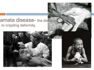 namata disease- the disease
s to crippling deformity.
 
