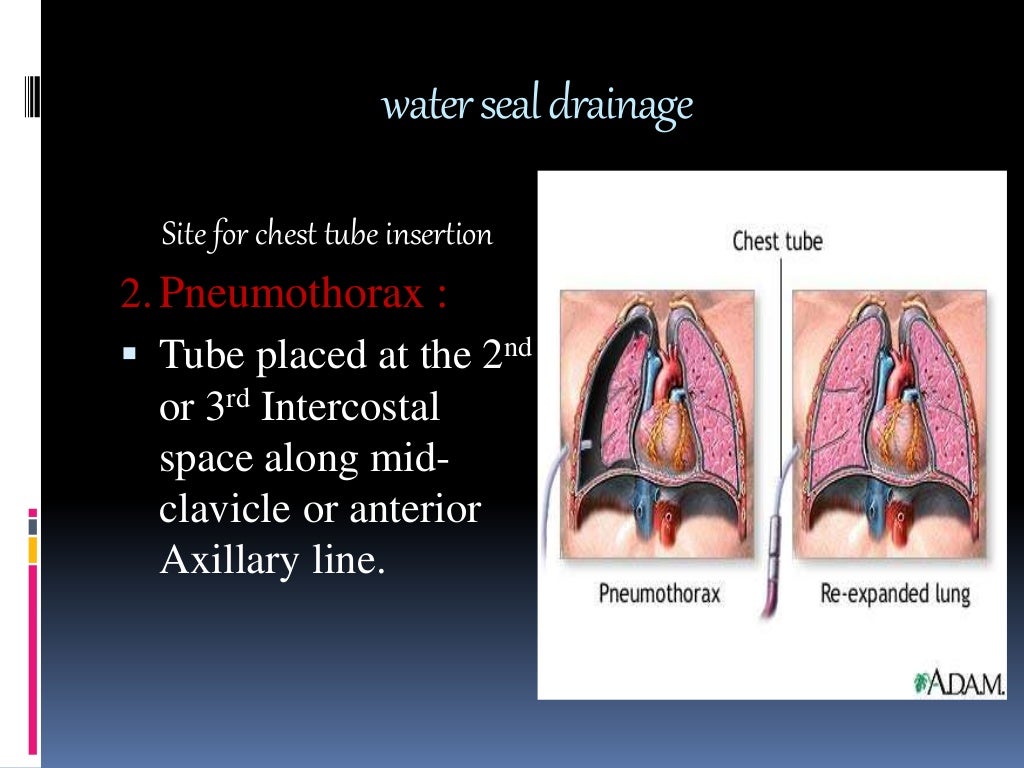 What Is The Water Seal Chamber at Chad Garcia blog