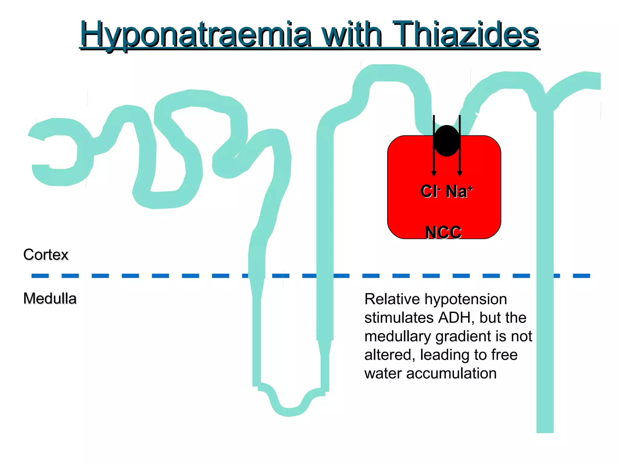CortexCortex
MedullaMedulla
ClCl--
NaNa++
NCCNCC
Hyponatraemia with ThiazidesHyponatraemia with Thiazides
Relative hypotension
stimulates ADH, but the
medullary gradient is not
altered, leading to free
water accumulation
 