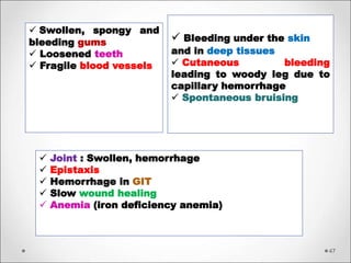 47
 Swollen, spongy and
bleeding gums
 Loosened teeth
 Fragile blood vessels
 Bleeding under the skin
and in deep tissues
 Cutaneous bleeding
leading to woody leg due to
capillary hemorrhage
 Spontaneous bruising
 Joint : Swollen, hemorrhage
 Epistaxis
 Hemorrhage in GIT
 Slow wound healing
 Anemia (iron deficiency anemia)
 