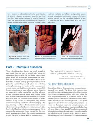Pollution and water-related disease
81
tion. However, we still need a much better understanding
of arsenic migration processes, accurate and low-
cost field water-testing methods, a good understand-
ing of the health effects and dose-response patterns of
chronic and low-level arsenic exposure, possible clinical
treatment methods, and efficient and practical arsenic
removal technologies. Accelerated research efforts are
urgently needed. Yet the immediate challenge is how
to take effective action without delay amid the many
unknowns.
Figure 5.20 Carcinoma of the hand
(Courtesy: Arsenic Foundation Inc.)
Figure 5.19 Melanosis of the hand
(Courtesy: Arsenic Foundation Inc.)
Figure 5.18 Keratosis on the feet
(Courtesy: Arsenic Foundation Inc.)
Part 2 Infectious diseases
Water-related infectious diseases are mostly spread via
two routes: from the bites of animal ‘hosts’ or vectors
carrying the disease, or via the‘faecal-oral’ route.Appro-
priate water and wastewater management can play a
vital role in reducing the incidence of both. In the second
half of the twentieth century, spraying water bodies with
pesticides became the preferred option for controlling
vectors, but avoiding low water levels, which promote
warmer water, and slack flows and stagnant water, which
favour mosquitoes, or waterfalls that favour black fly,
are more eco-friendly approaches. Installing adequate
sewage treatment systems, along with hygiene educa-
tion, is the main route to preventing faecal-oral disease.
Poor sanitation can also increase the number of vector
animals. Many vectors, like mosquitoes, only become
infectious once they have bitten a human carrying a dis-
ease. Growing population densities increase the chances
of infection in tropical and subtropical countries, but the
low level of baseline infection mitigates against this in
more northerly countries. Other vectors, like the water
snails which carry the flukes that cause schistosomiasis,
acquire the agent of disease without human contact.
No-plumbing disease
Almost four children die every minute from poor sanita-
tion and water supply. The World Bank estimates that
two million people die of sanitation-related disease every
year, 90 per cent of them children. John Sauer coined the
term ‘no-plumbing disease’ in an internet article he pub-
lished in January 2009. Sauer is Communications Direc-
tor for Water Advocates of Washington, DC, a non-profit
organization devoted to publicizing water problems. He
points out that clean water and sanitation receive far
less attention and funding than malaria or Aids, but they
kill more children than Aids/HIV, malaria, measles and
tuberculosis combined. In total, some two million deaths
are linked each year to unsafe water and poor sanita-
tion and hygiene, equivalent to ten 2004 Indian Ocean
‘The most practical investment we can
make in global public health is plumbing.’
John Sauer, Communications Director,
Water Advocates, Washington, DC, 2009
 