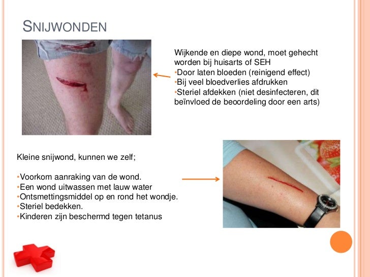 wat te doen tegen maagpijn