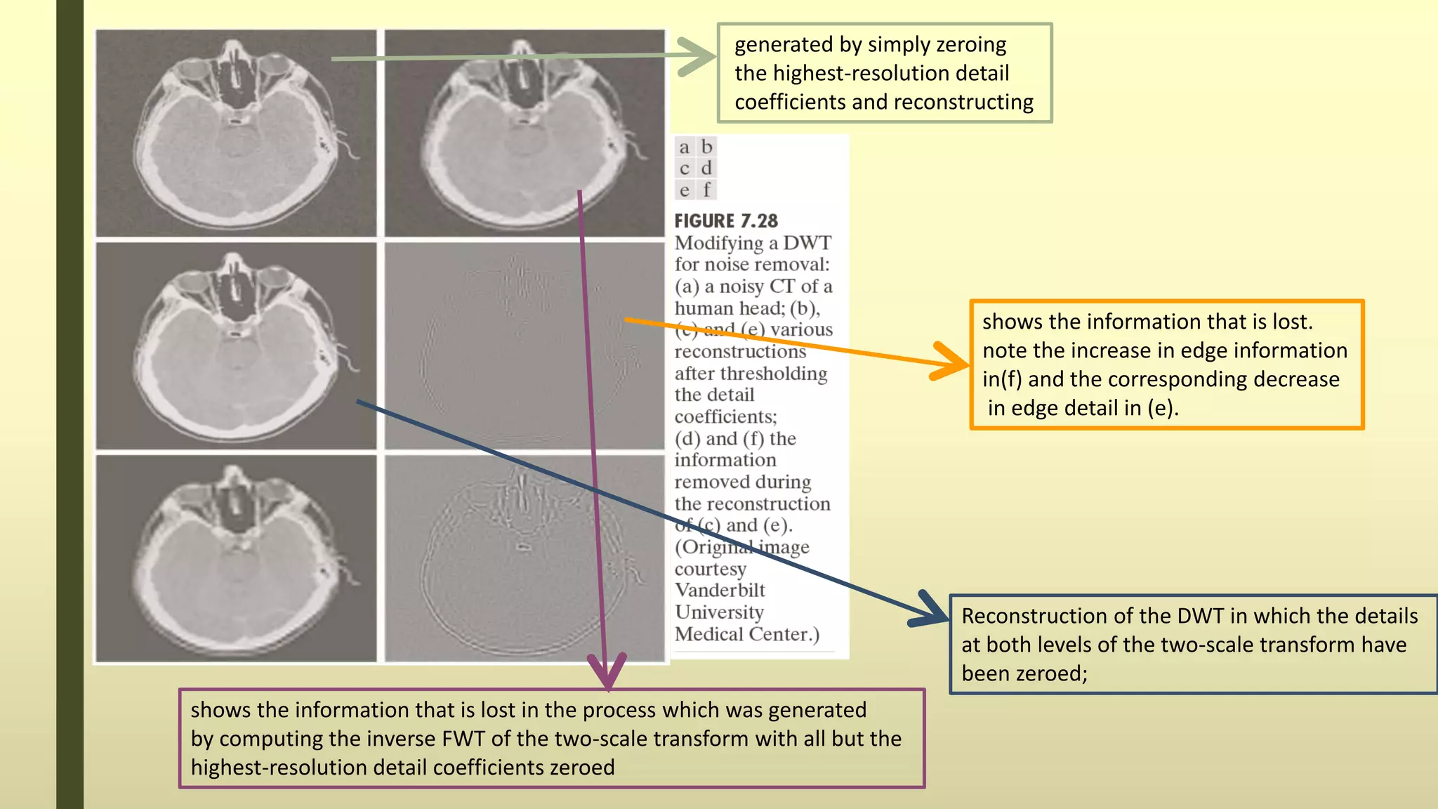 shows the information that is lost.
note the increase in edge information
in(f) and the corresponding decrease
in edge detail in (e).
generated by simply zeroing
the highest-resolution detail
coefficients and reconstructing
shows the information that is lost in the process which was generated
by computing the inverse FWT of the two-scale transform with all but the
highest-resolution detail coefficients zeroed
Reconstruction of the DWT in which the details
at both levels of the two-scale transform have
been zeroed;
 