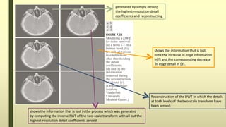 shows the information that is lost.
note the increase in edge information
in(f) and the corresponding decrease
in edge detail in (e).
generated by simply zeroing
the highest-resolution detail
coefficients and reconstructing
shows the information that is lost in the process which was generated
by computing the inverse FWT of the two-scale transform with all but the
highest-resolution detail coefficients zeroed
Reconstruction of the DWT in which the details
at both levels of the two-scale transform have
been zeroed;
 