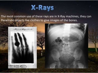 The most common use of these rays are in X-Ray machines, they can
Penetrate objects like clothes to give images of the bones.
 