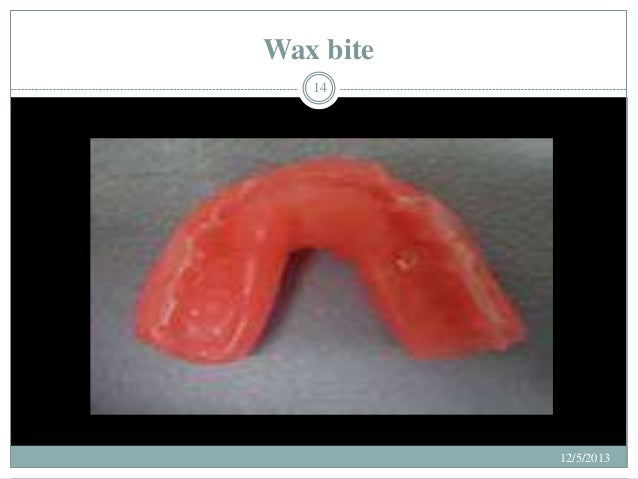 waxes dentistry