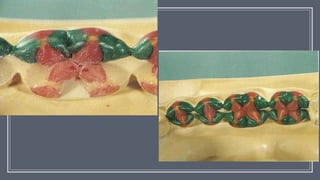 wax pattern, Esthetic and Occlusal Considerations | PPTX