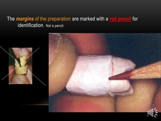 18
The margins of the preparation are marked with a red pencil for
identification. Not a pencil.
 