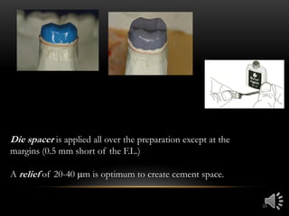 23
Die spacer is applied all over the preparation except at the
margins (0.5 mm short of the F.L.)
A relief of 20-40 m is optimum to create cement space.
 