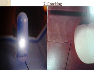 Wax Pattern Defect awareness training material | PPSX