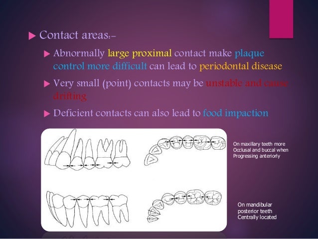 dentures