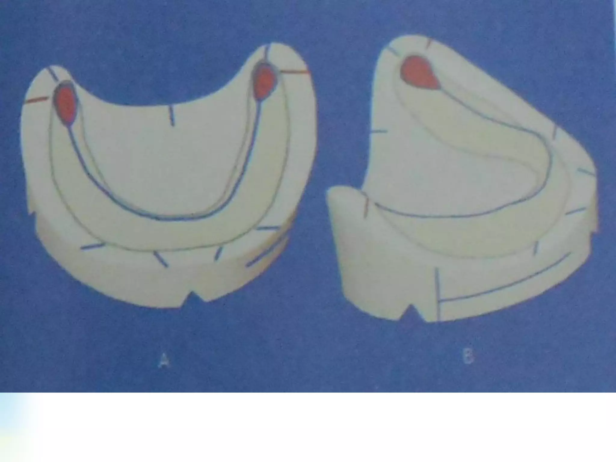 Wax Rim Model Wax rims & jaw relations | PDF