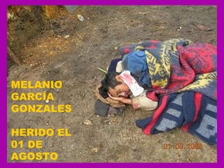 MELANIO GARCÍA GONZALES  HERIDO EL 01 DE AGOSTO  