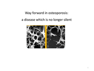 Way forward in osteoporosis: a disease which is no longer silent 