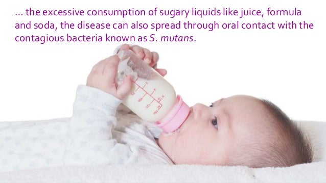 Ways To Prevent Baby Bottle Tooth Decay