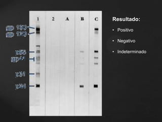 Resultado:
• Positivo
• Negativo
• Indeterminado
 