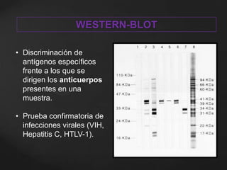 WESTERN-BLOT
• Discriminación de
antígenos específicos
frente a los que se
dirigen los anticuerpos
presentes en una
muestra.
• Prueba confirmatoria de
infecciones virales (VIH,
Hepatitis C, HTLV-1).
 