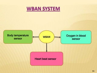 WBAN SYSTEM
Body temperature
sensor
Heart beat sensor
Oxygen in blood
sensor
WBAN
11
 