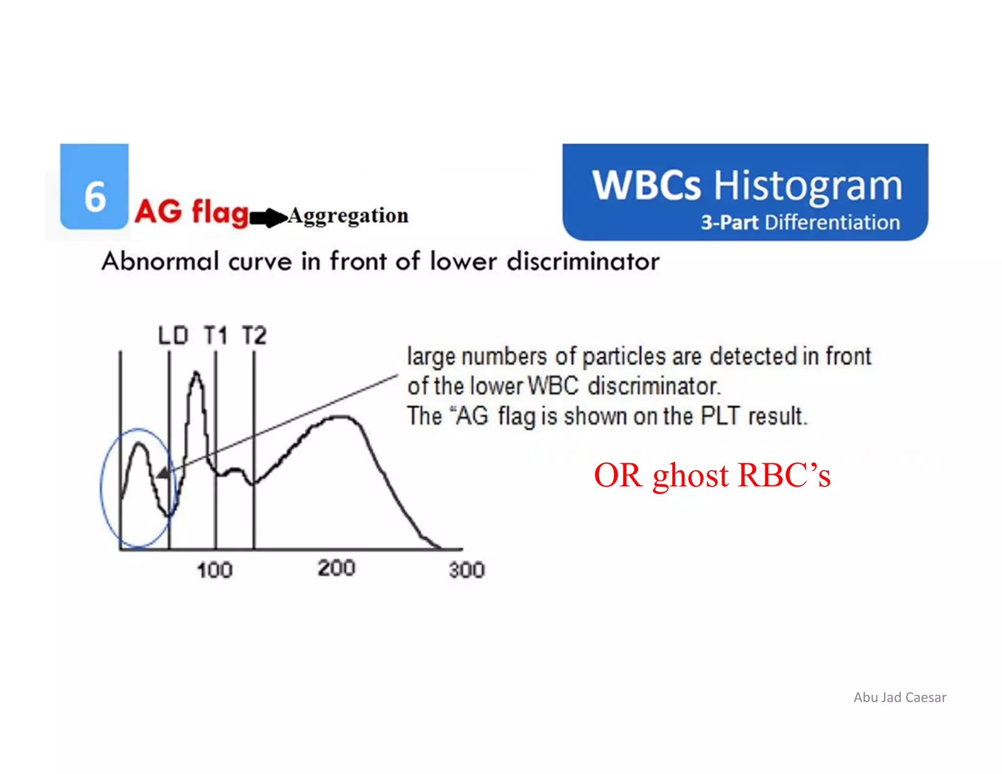 Wbc histogram ppt