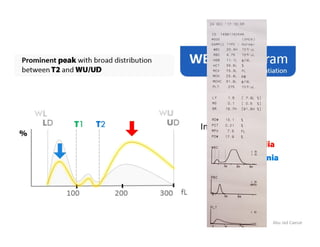 Wbc Scan Graph WBC Histogram | PDF