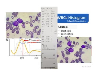 Updated - WBC histogram | PDF