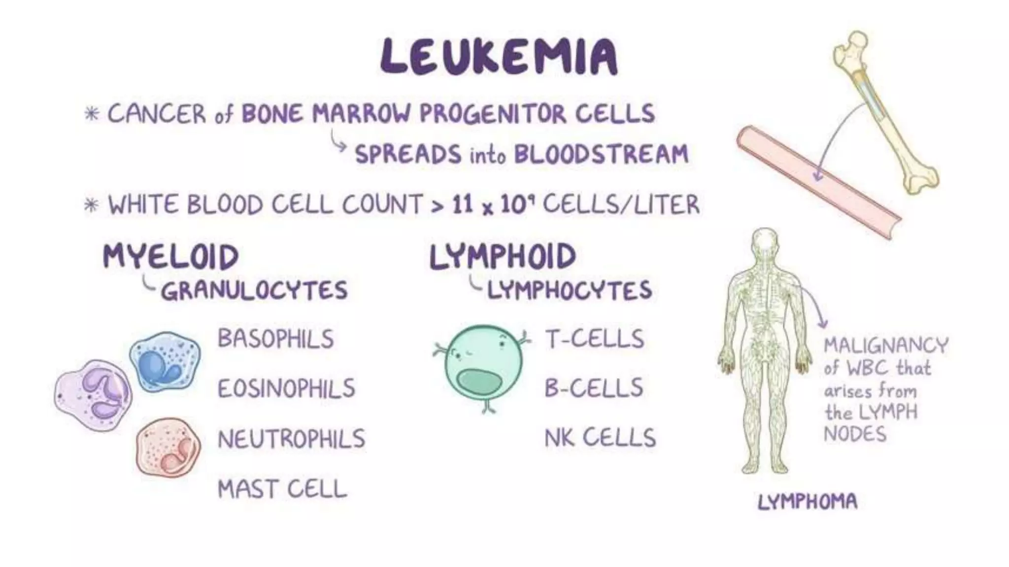 Myeloid neoplasm . Dr. Abhinav Golla , Associate Professor , Lab Director & Consultant Pathologist . Aadhya Medicure Pathlabs .