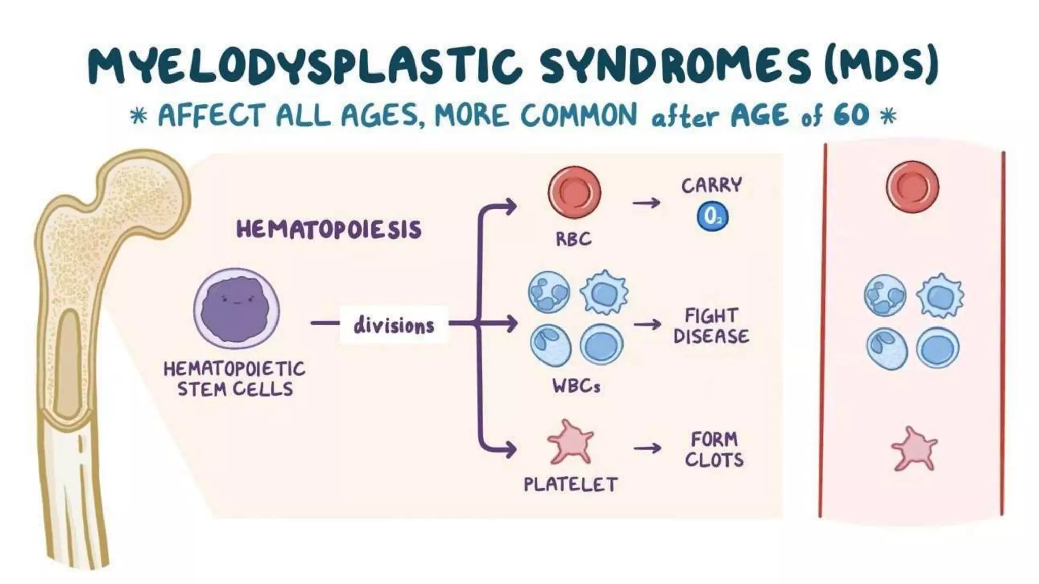 Myeloid neoplasm . Dr. Abhinav Golla , Associate Professor , Lab Director & Consultant Pathologist . Aadhya Medicure Pathlabs .