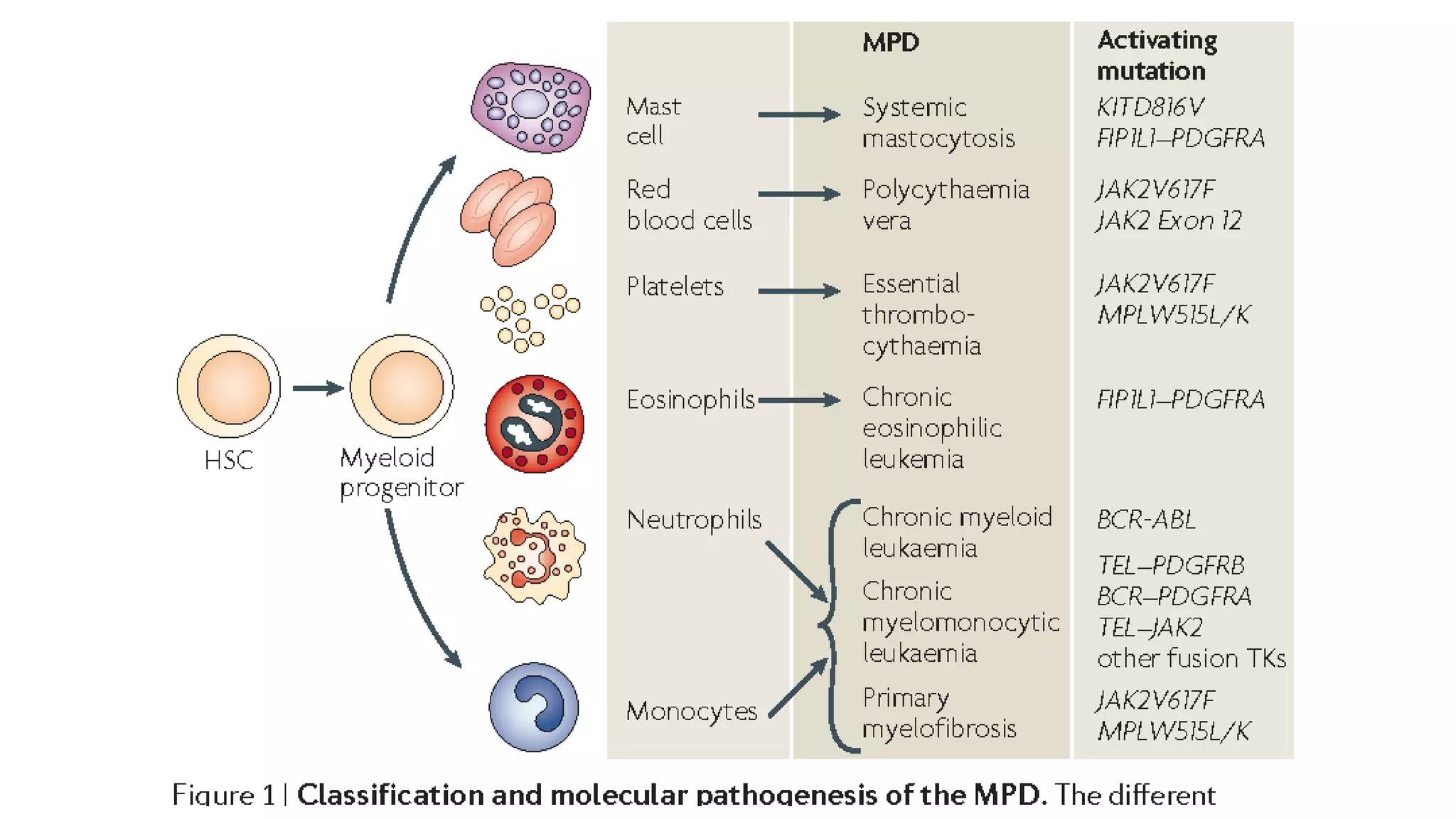Myeloid neoplasm . Dr. Abhinav Golla , Associate Professor , Lab Director & Consultant Pathologist . Aadhya Medicure Pathlabs .