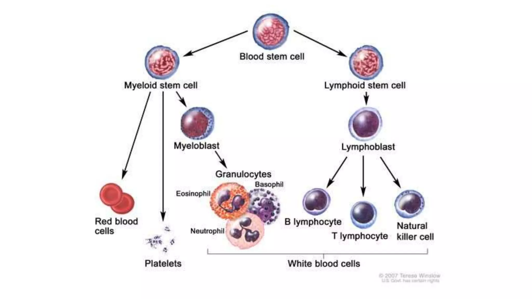 Myeloid neoplasm . Dr. Abhinav Golla , Associate Professor , Lab Director & Consultant Pathologist . Aadhya Medicure Pathlabs .