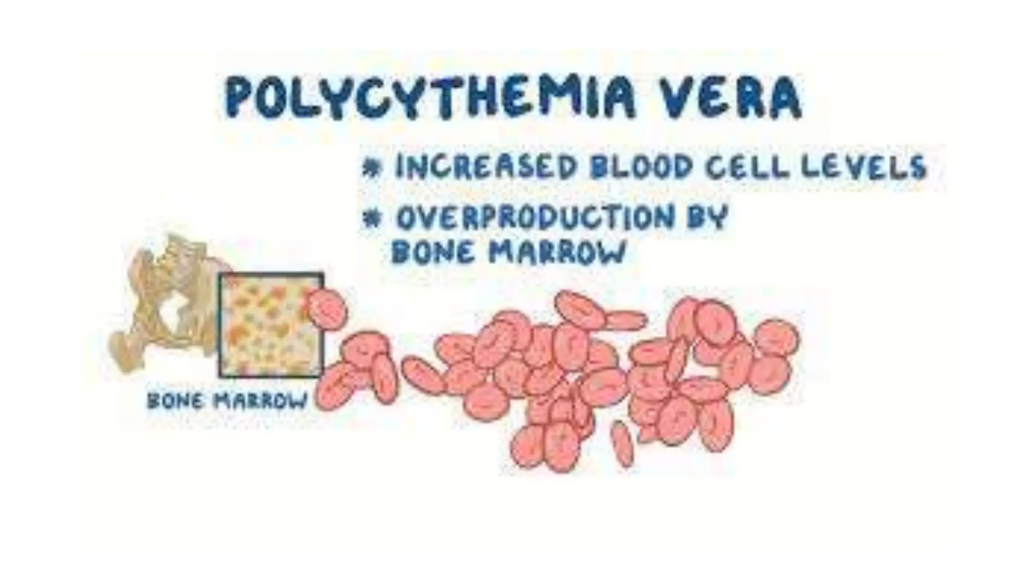 Myeloid neoplasm . Dr. Abhinav Golla , Associate Professor , Lab Director & Consultant Pathologist . Aadhya Medicure Pathlabs .