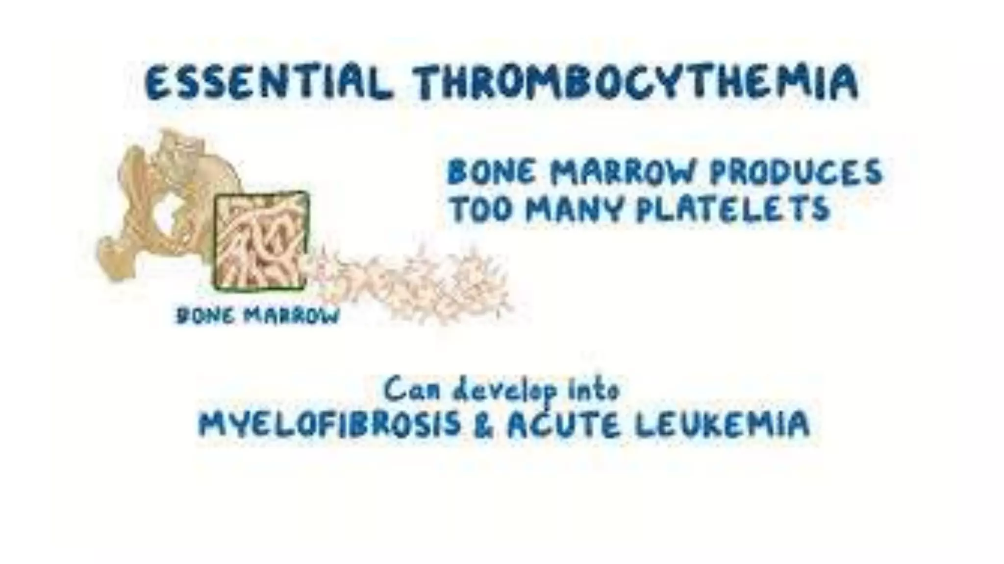 Myeloid neoplasm . Dr. Abhinav Golla , Associate Professor , Lab Director & Consultant Pathologist . Aadhya Medicure Pathlabs .