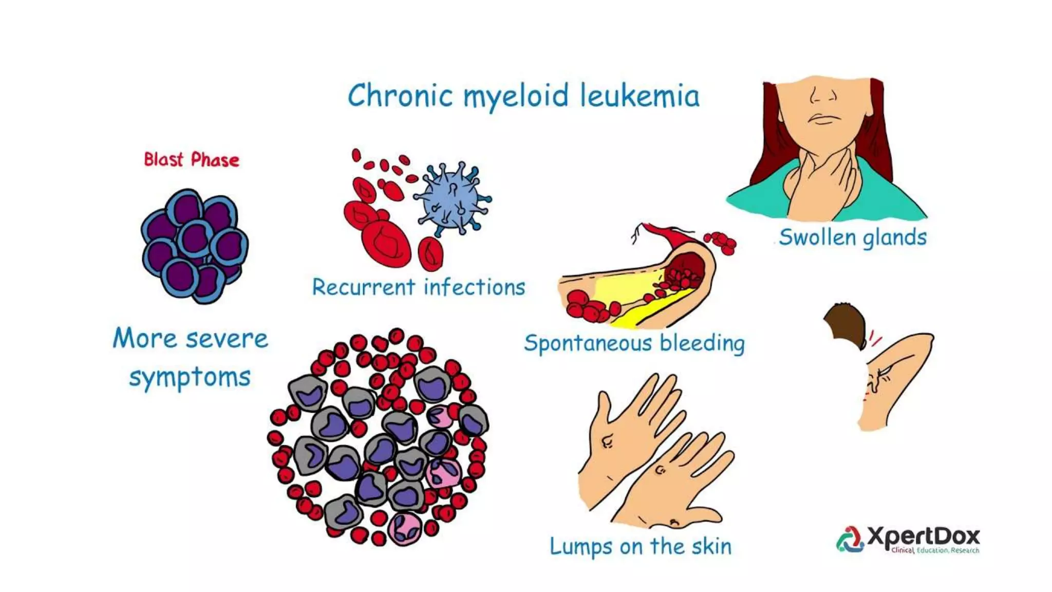 Myeloid neoplasm . Dr. Abhinav Golla , Associate Professor , Lab Director & Consultant Pathologist . Aadhya Medicure Pathlabs .