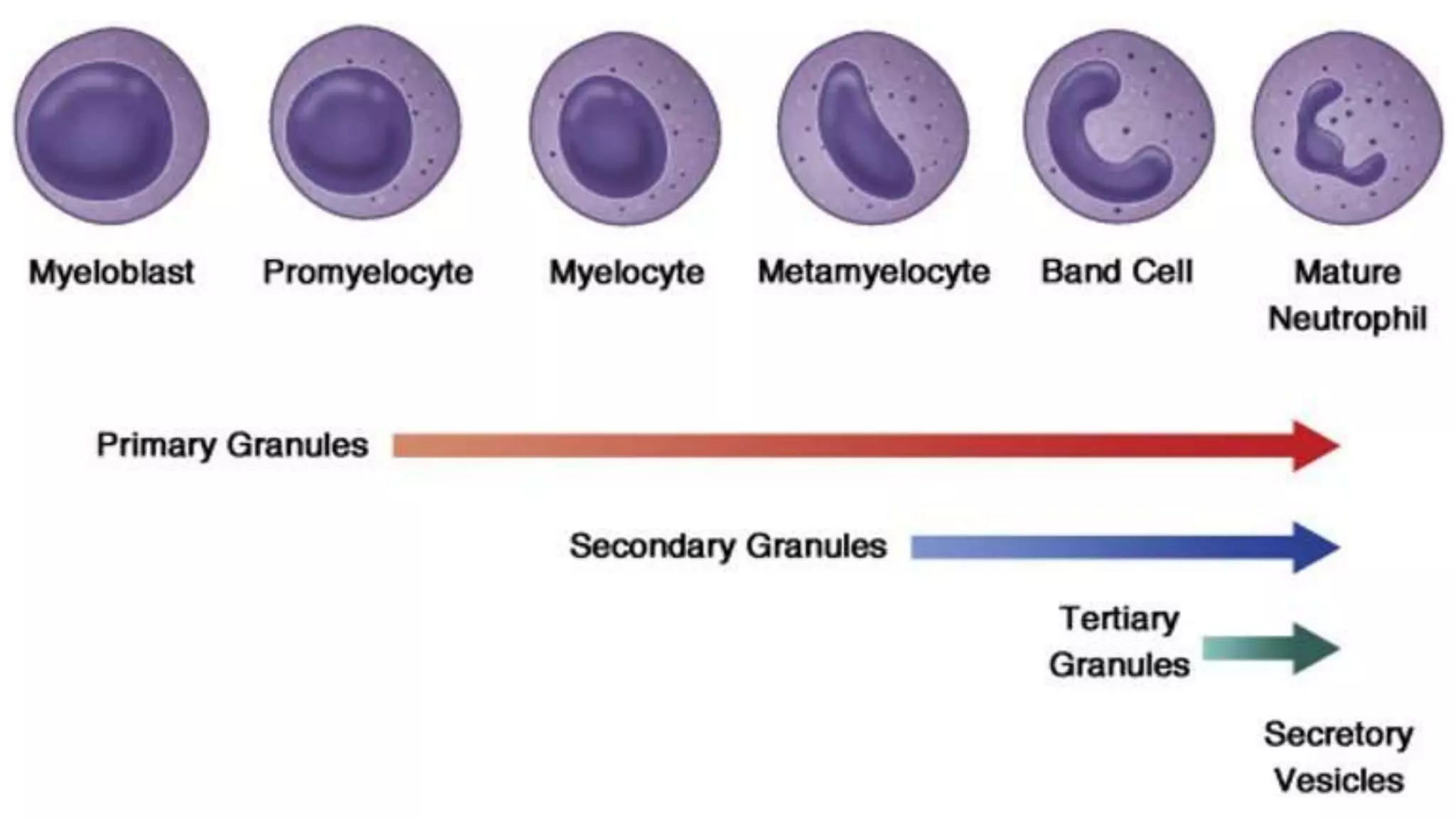 Myeloid neoplasm . Dr. Abhinav Golla , Associate Professor , Lab Director & Consultant Pathologist . Aadhya Medicure Pathlabs .