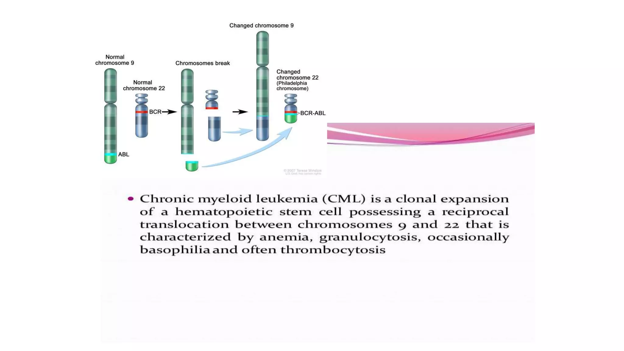 Myeloid neoplasm . Dr. Abhinav Golla , Associate Professor , Lab Director & Consultant Pathologist . Aadhya Medicure Pathlabs .